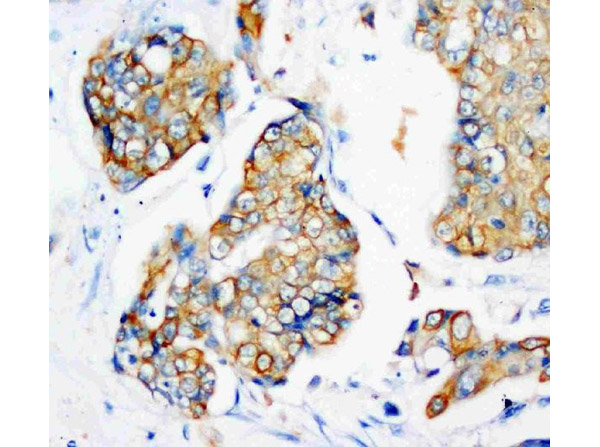 Immunohistochemistry analysis of Cytokeratin Peptide 18